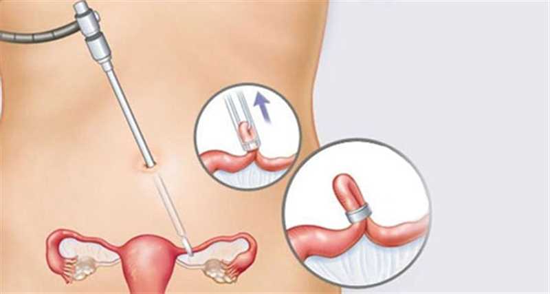 متخصص توبکتومی در شیراز